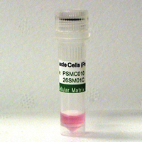 写真 大動脈血管平滑筋細胞