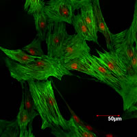 写真 大動脈血管平滑筋細胞